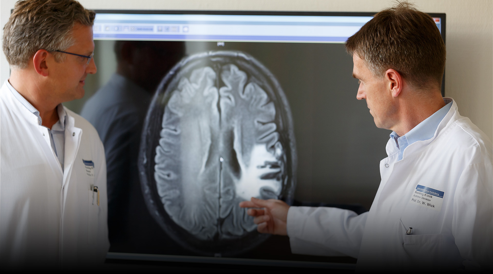 Doctors in front of brain tumorscan (photo)